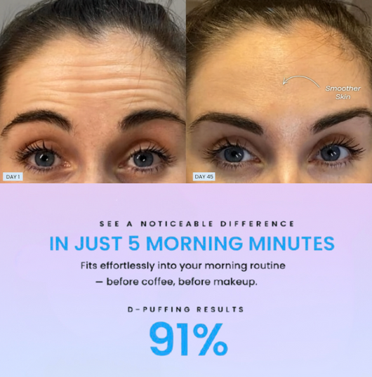 GlowLift™ Red Light Face Sculptor