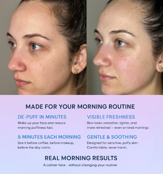 GlowLift™ Red Light Face Sculptor