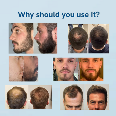 Hair Growth Roll-On Serum