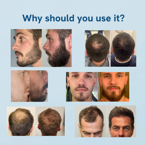 Hair Growth Roll-On Serum