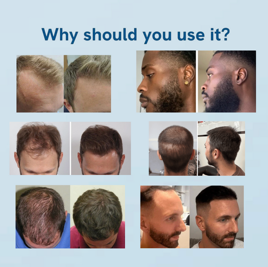 Hair Growth Roll-On Serum