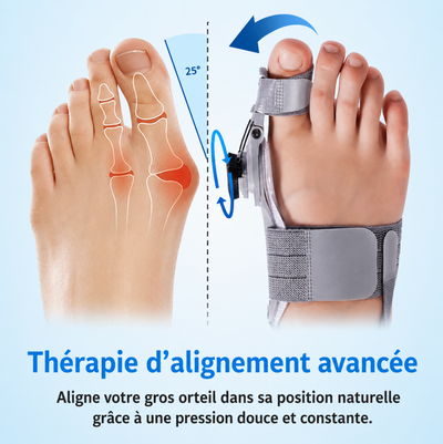 Lunava™  Correcteur d'Oignon Sans Chirurgie
