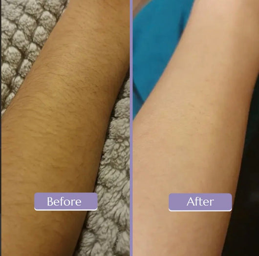 Lunava Crystal Hair Eraser